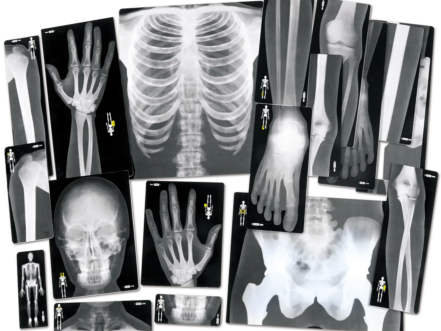 Human X-Rays - Set of 18