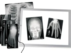 Human X-Rays - Set of 18