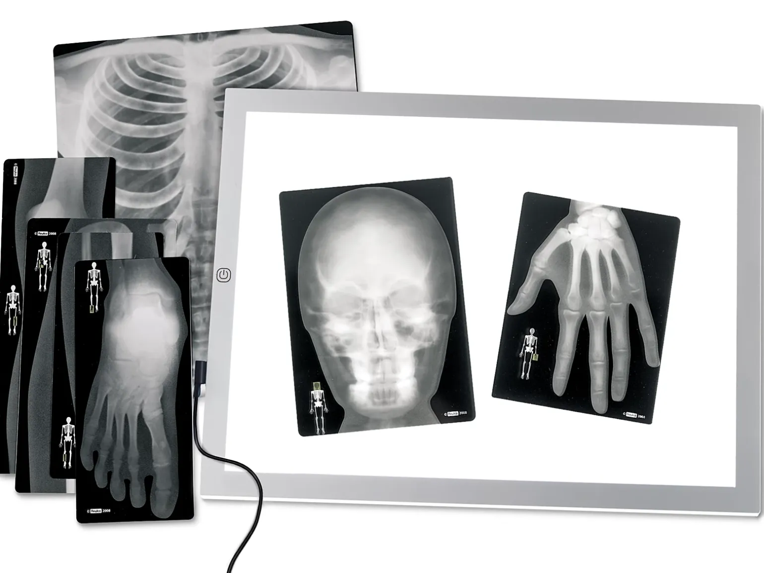 Human X-Rays - Set of 18